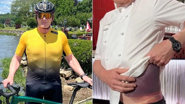 Gordon Ramsay’s ‘Really Bad’ Bike Accident: Everything We Know So Far